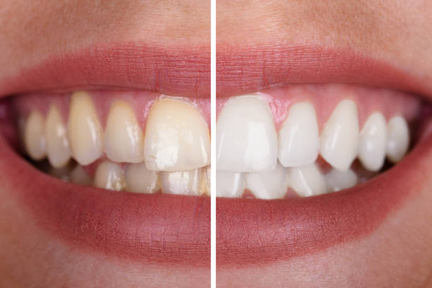 general dentistry