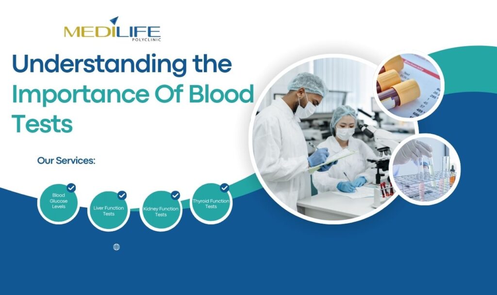 Five Reasons To Have Regular Blood Tests