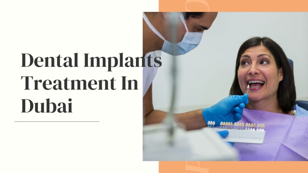 Dental implants treatment in Dubai