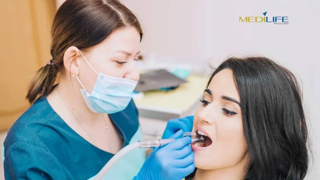 Periodontal Treatment in Dubai