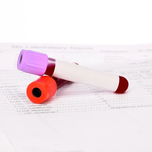 Culture And Sensitivity Testing In Dubai