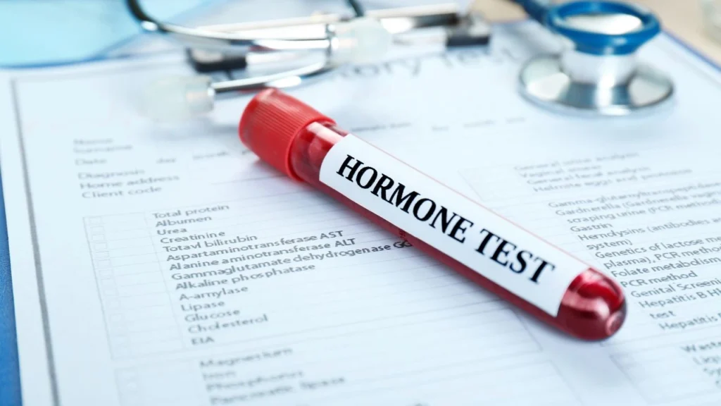 Hormone Test In Al Quoz