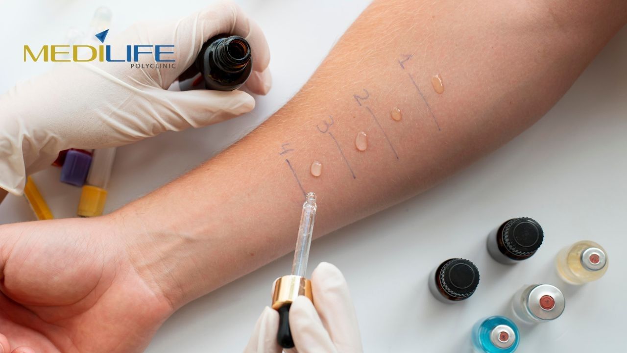Allergy Test in Al Quoz