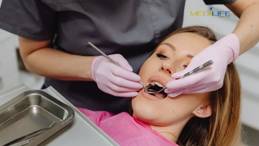 Wisdom Tooth Extraction In Al Quoz