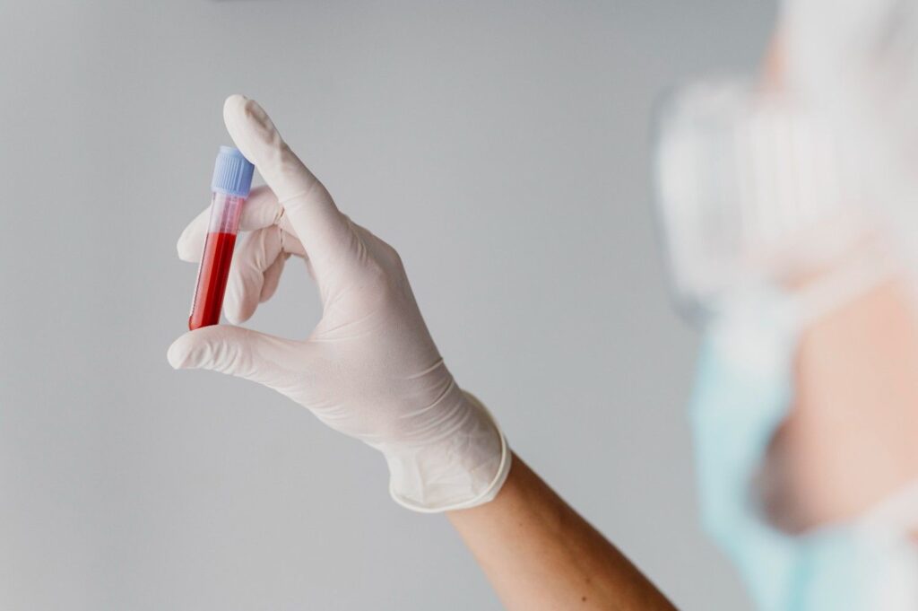 Where Can I Book a Comprehensive Laboratory Blood Test in Dubai?