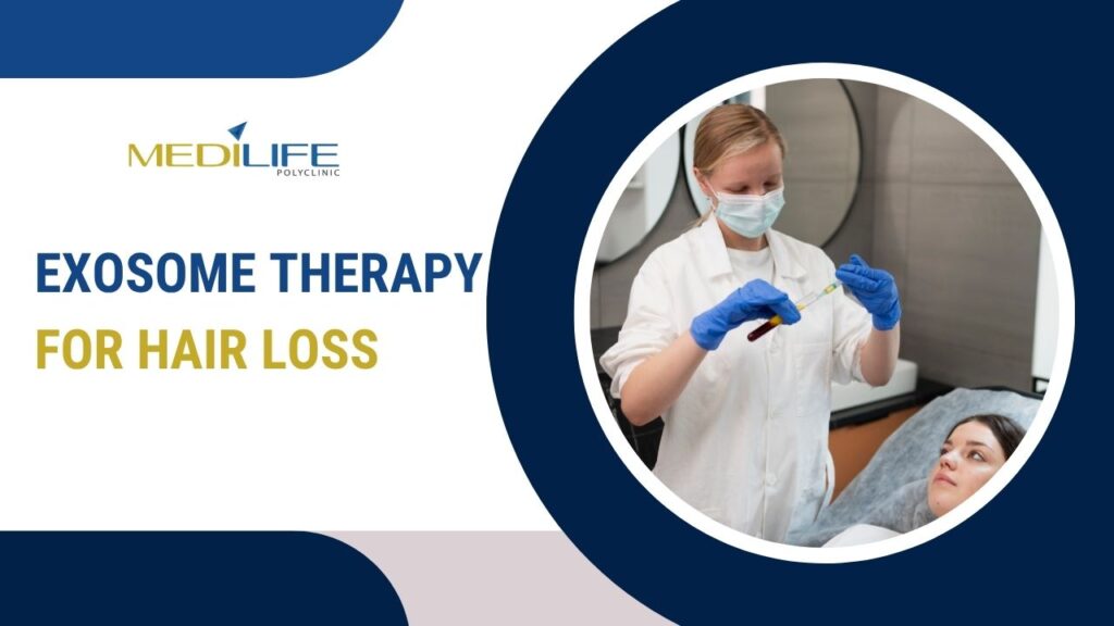 Exosome therapy for hair loss