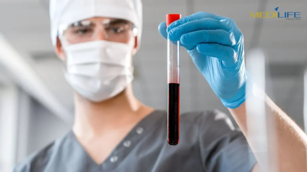 Hormone Test Dubai