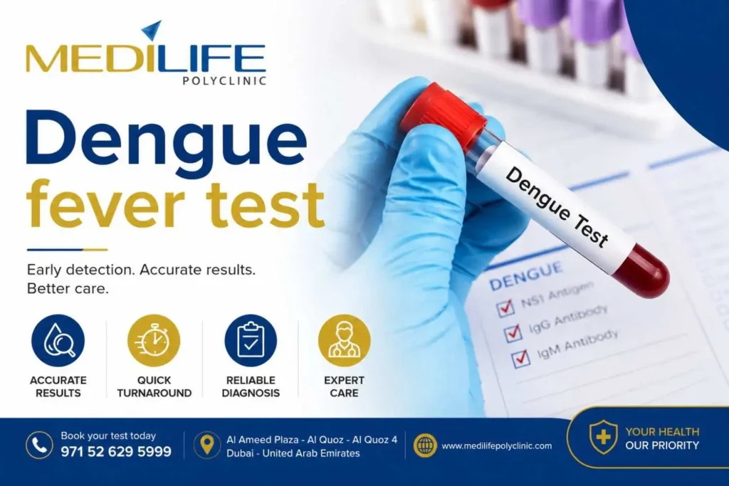 dengue fever test