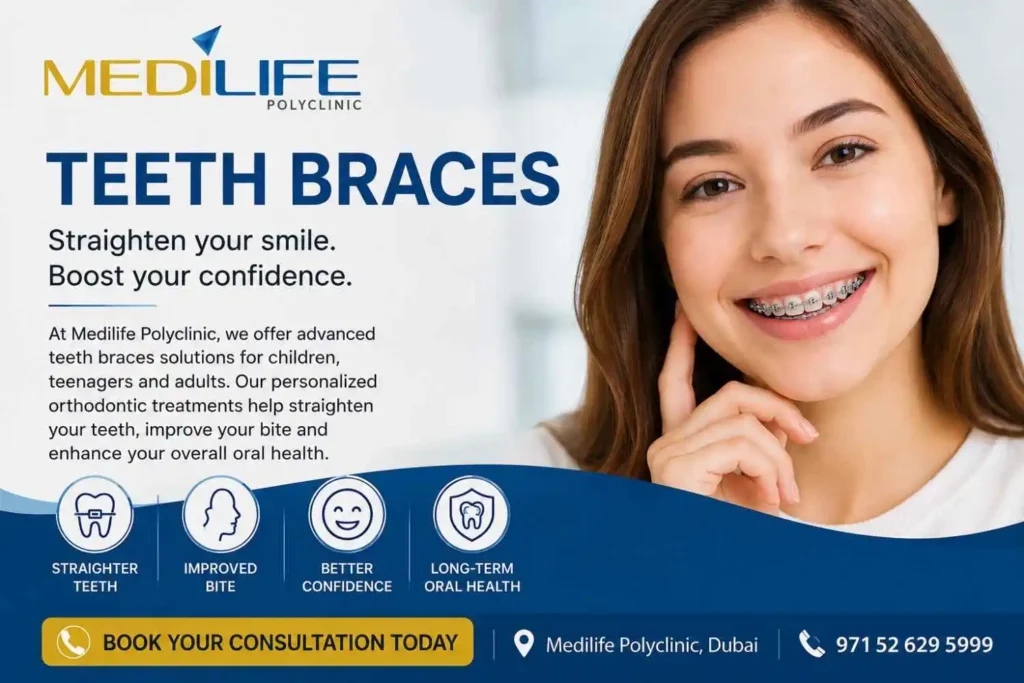 Teeth braces