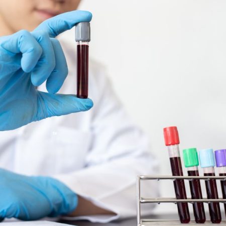 blood testing (12) kidney function test