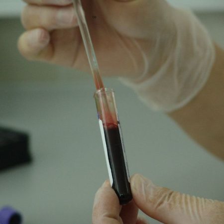 blood testing (5) blood testing services in united arab emarites